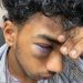 ചാത്തമംഗലം MES കോളജിൽ ഭീഷണിയും റാഗിങ് മർദ്ദനവും