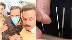 അക്യൂപങ്ക്ചർ നടത്തുന്ന വ്യാജൻമാരെ തടയണമെന്ന് ഇനിഗ്മ