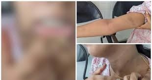 സ്ത്രീധനത്തിന്റെ പേരില് ക്രൂരമര്ദനം; പൊലീസിനെതിരെ ഗുരുതര ആരോപണവുമായി പെണ്കുട്ടി, മുഖ്യമന്ത്രിക്ക് പരാതി