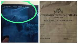 34കാരിക്ക് മരുന്ന് നൽകിയത് 64കാരിയുടെ എക്സ്റേ പ്രകാരം; കളമശ്ശേരി മെഡിക്കൽ കോളേജിൽ ചികിത്സാപ്പിഴവെന്ന് പരാതി