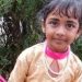പ്രതിരോധ വാക്സിൻ എടുത്തിട്ടും പേവിഷബാധയേറ്റ അഞ്ച് വയസുകാരി മരിച്ചു; അന്ത്യം കോഴിക്കോട് മെഡി. കോളേജില്