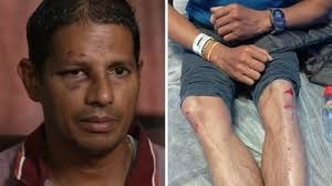 ഇന്ത്യൻ വംശജരുടെ ഭീതിയൊഴിയുന്നില്ല; ആറ് വയസുകാരിക്ക് പിന്നാലെ 51കാരനും അയർലണ്ടിൽ ക്രൂര മർദ്ദനം