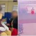 ആസിഡ് ആക്രമണ പരാതിയിൽ വൻ ട്വിസ്റ്റ്; പെണ്‍കുട്ടി കൈ പൊള്ളിച്ചത് ടോയ്‍ലറ്റ് ക്ലീനർ ഉപയോഗിച്ച്, ആസൂത്രണം ചെയ്തത് പിതാവെന്ന് പൊലീസ്