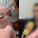 കൊഴുപ്പുമാറ്റിവയ്ക്കൽ ശസ്ത്രക്രിയയ്ക്ക് പിന്നാലെ കൈവിരലുകൾ മുറിച്ചുമാറ്റി, 7 മാസം കഴിഞ്ഞിട്ടും നീതികിട്ടാതെ യുവതി