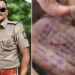 കൈവെള്ളയിൽ ആത്മഹത്യക്കുറിപ്പെഴുതി ഡോക്ടർ ജീവനൊടുക്കിയ സംഭവം; 2 പൊലീസുകാർക്കെതിരെ എഫ്ഐആർ, അന്വേഷണമാരംഭിച്ചു