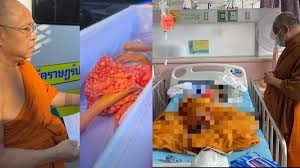ശവപ്പെട്ടിയുടെ വശങ്ങളിൽ മുട്ടും തട്ടും, തുറന്നപ്പോൾ കണ്ണ് തുറന്ന് തലയും കയ്യും അനക്കി 65കാരിയുടെ മൃതദേഹം