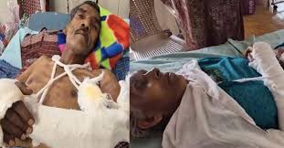 പറമ്പില് കോഴി കയറിയതിന് വൃദ്ധദമ്പതികളുടെ കൈകൾ ഇരുമ്പുവടി കൊണ്ട് തല്ലിയൊടിച്ചു; ഒളിവിലായിരുന്ന അയല്വാസി പിടിയില്